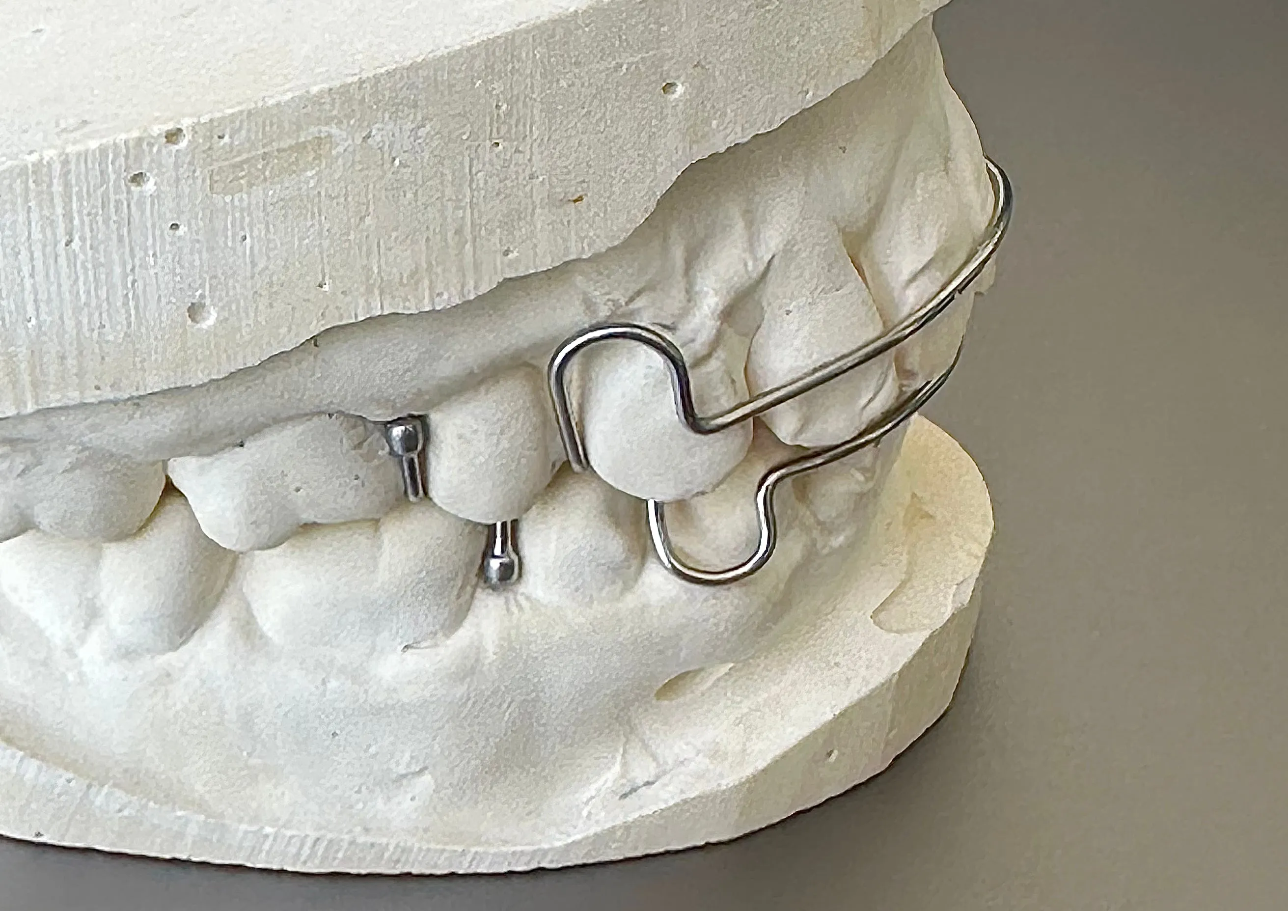 Hawley Orthodontic Retainer,  Buy One Get One 30% Off BOGO! Use code: HAWLEY30